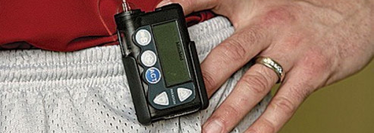 مضخات الأنسولين